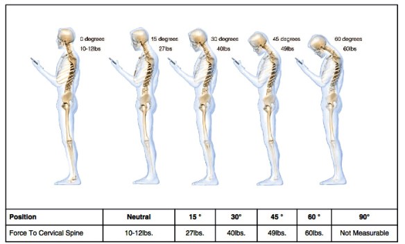 WhatTextingDoesToSpine
